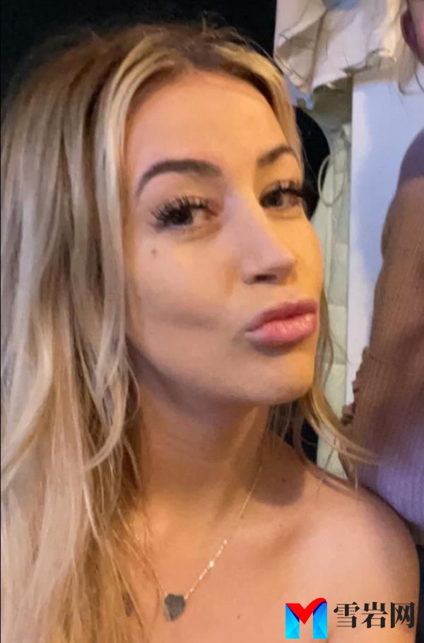 Courtney Taaffe never realized dissolving her filler would make her lips larger.