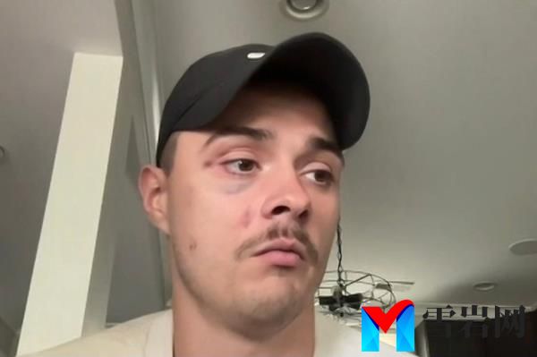 Dingus claims a worker got aggressive when he asked for a timing update and his partner pulled him aside in a bid to diffuse the situation.