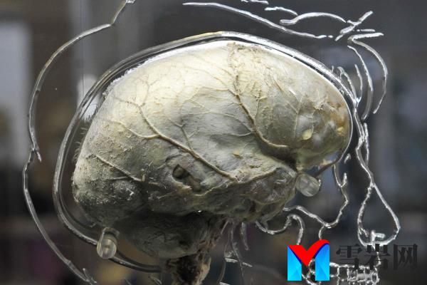 新的mRNA癌症疫苗触发免疫系统对抗侵袭性脑肿瘤