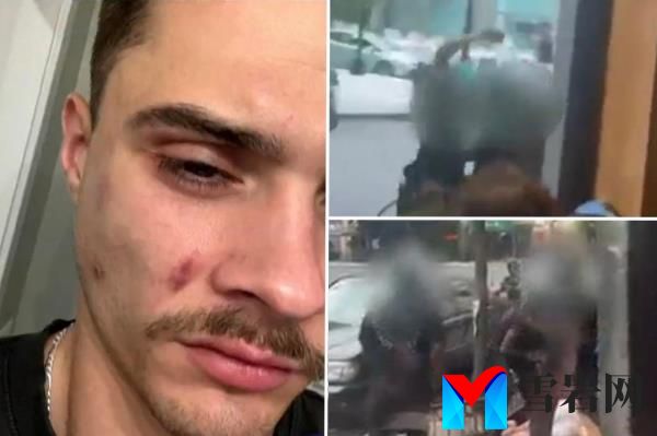 一名同性恋男子在亲吻男友后被Shake Shack员工殴打