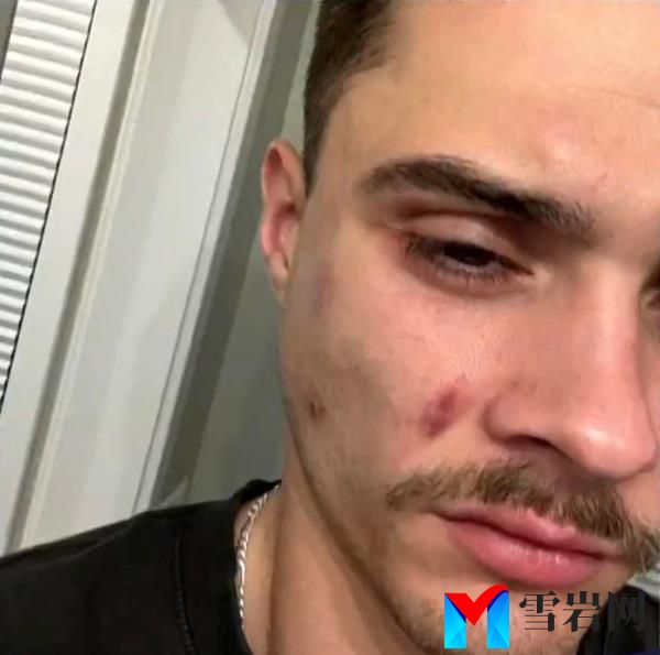Christian Dingus, 28, alleges the violence unfolded at the fast food chain